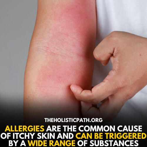 Common reason for itching is allergy 